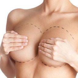 Breast Aesthetics