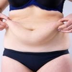 How Much Does Tummy Tuck Cost?